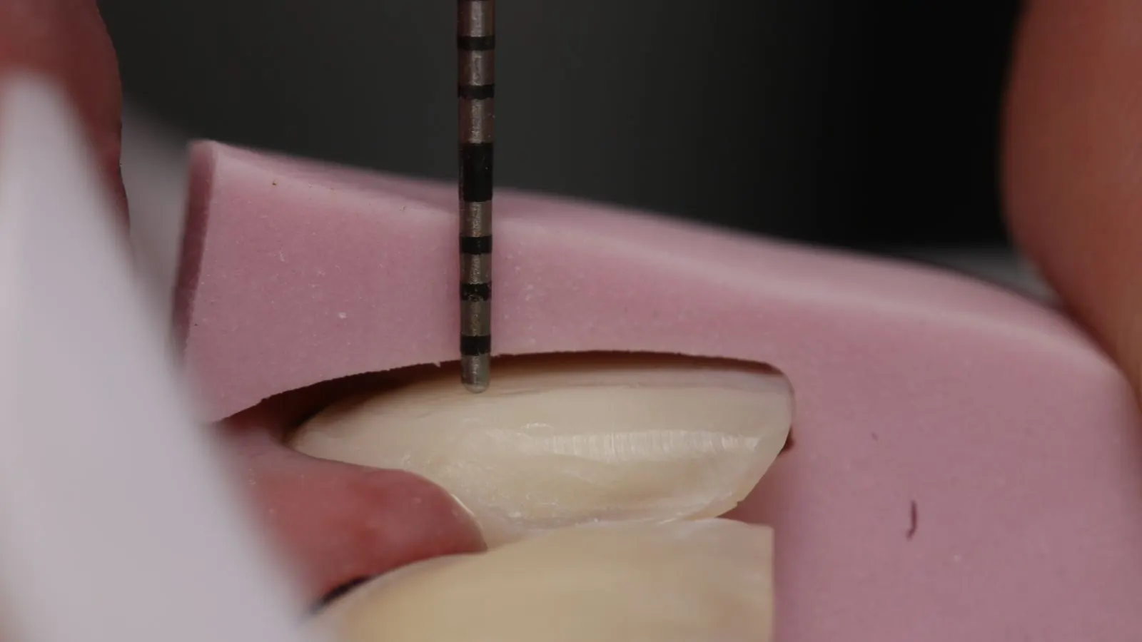 Prótese dentária estética